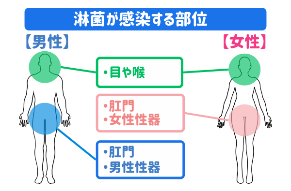 淋病が感染する部位
