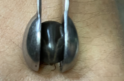 人間に付着したマダニ除去