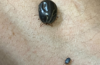 飽血した正ダニと若ダニ