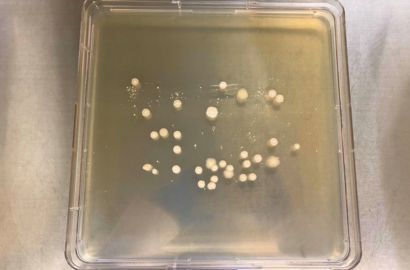 外勤男性1日着用24時間後外側