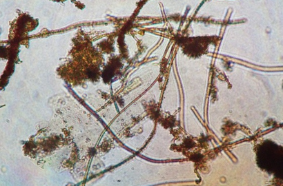 棒状に伸びているものが鉄細菌の鞘